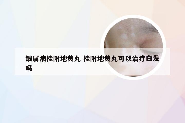 银屑病桂附地黄丸 桂附地黄丸可以治疗白发吗