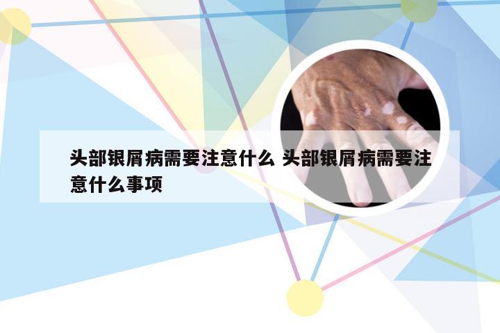 头部银屑病需要注意什么 头部银屑病需要注意什么事项