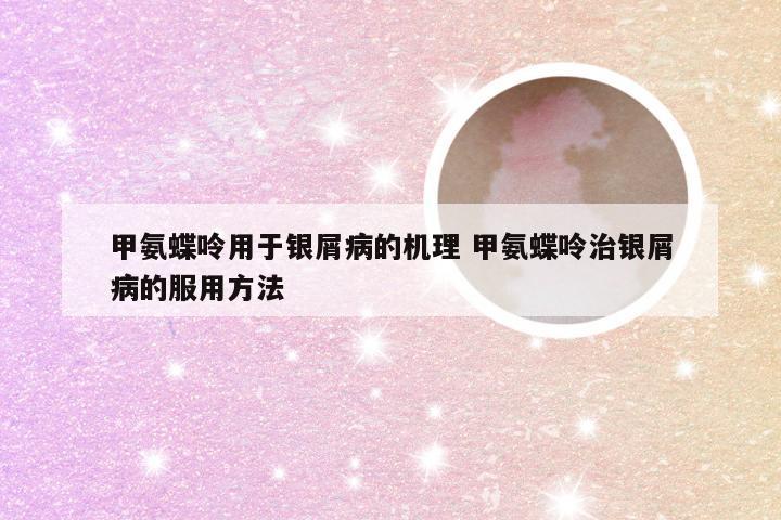 甲氨蝶呤用于银屑病的机理 甲氨蝶呤治银屑病的服用方法