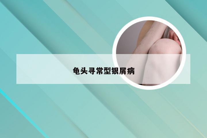 龟头寻常型银屑病