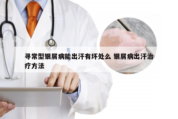 寻常型银屑病能出汗有坏处么 银屑病出汗治疗方法