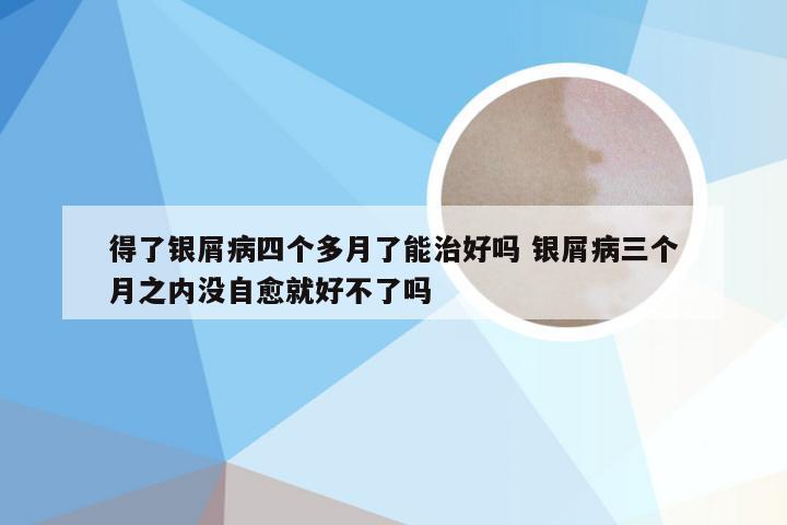 得了银屑病四个多月了能治好吗 银屑病三个月之内没自愈就好不了吗