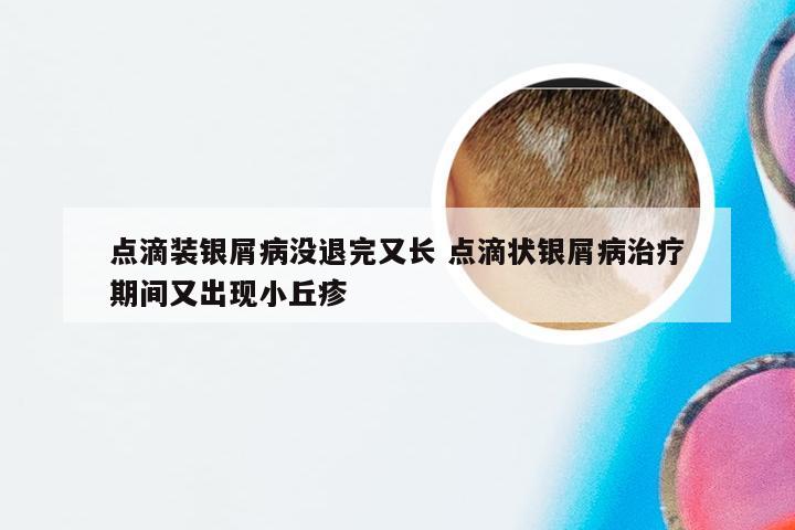 点滴装银屑病没退完又长 点滴状银屑病治疗期间又出现小丘疹