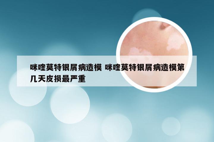 咪喹莫特银屑病造模 咪喹莫特银屑病造模第几天皮损最严重