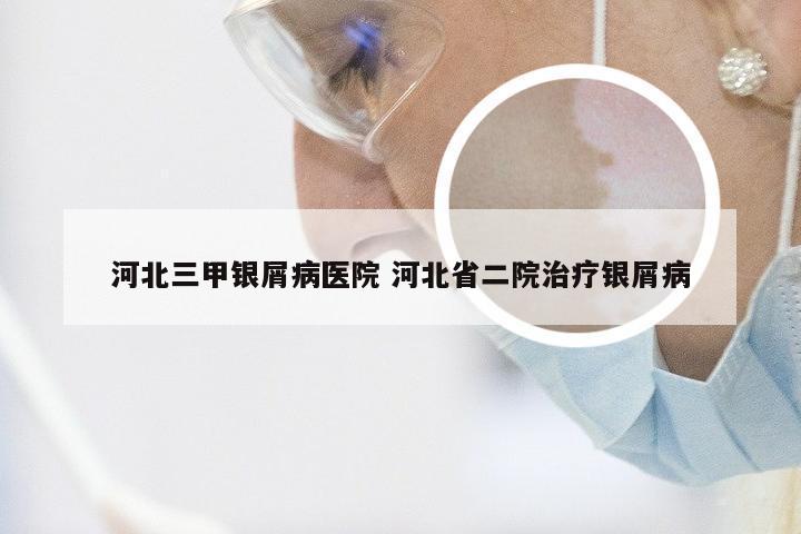 河北三甲银屑病医院 河北省二院治疗银屑病