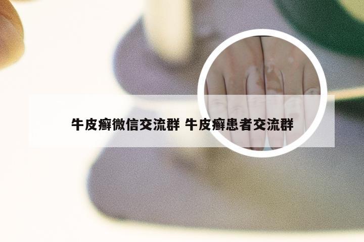 牛皮癣微信交流群 牛皮癣患者交流群