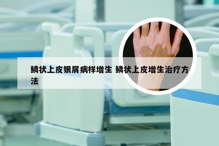 鳞状上皮银屑病样增生 鳞状上皮增生治疗方法