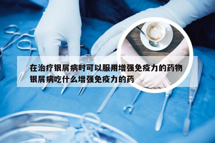 在治疗银屑病时可以服用增强免疫力的药物 银屑病吃什么增强免疫力的药