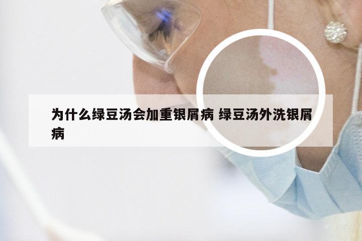 为什么绿豆汤会加重银屑病 绿豆汤外洗银屑病