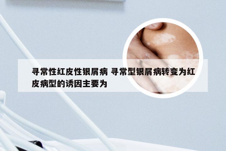 寻常性红皮性银屑病 寻常型银屑病转变为红皮病型的诱因主要为