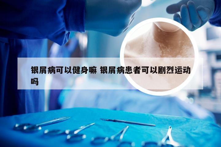 银屑病可以健身嘛 银屑病患者可以剧烈运动吗