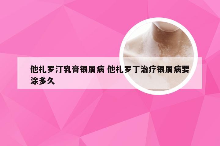 他扎罗汀乳膏银屑病 他扎罗丁治疗银屑病要涂多久