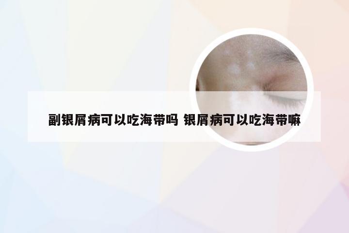 副银屑病可以吃海带吗 银屑病可以吃海带嘛