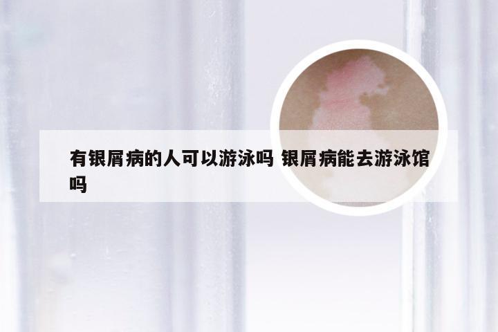 有银屑病的人可以游泳吗 银屑病能去游泳馆吗