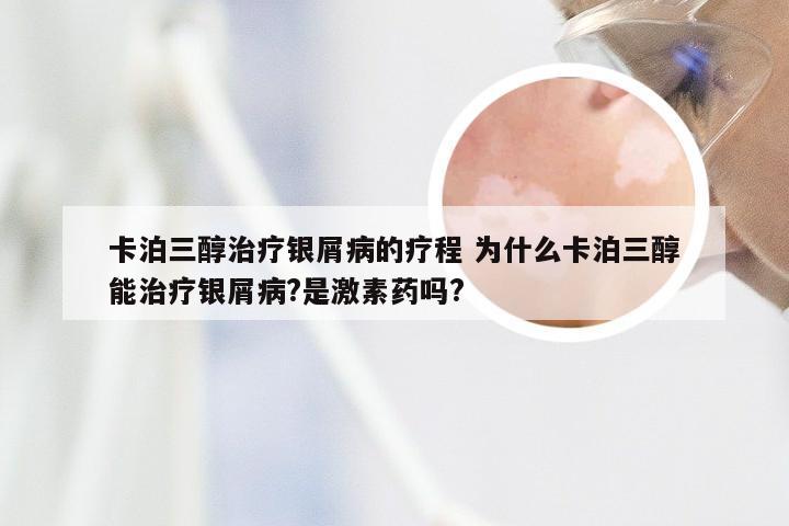 卡泊三醇治疗银屑病的疗程 为什么卡泊三醇能治疗银屑病?是激素药吗?