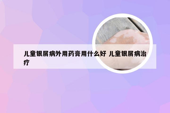 儿童银屑病外用药膏用什么好 儿童银屑病治疗