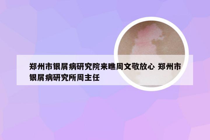 郑州市银屑病研究院来瞧周文敬放心 郑州市银屑病研究所周主任