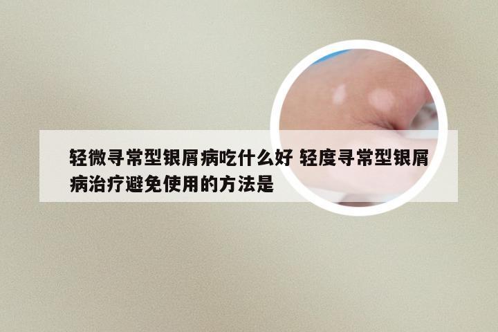 轻微寻常型银屑病吃什么好 轻度寻常型银屑病治疗避免使用的方法是