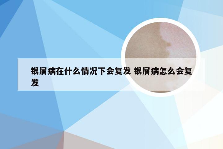 银屑病在什么情况下会复发 银屑病怎么会复发