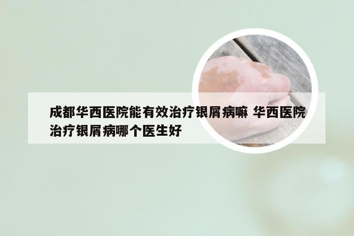成都华西医院能有效治疗银屑病嘛 华西医院治疗银屑病哪个医生好