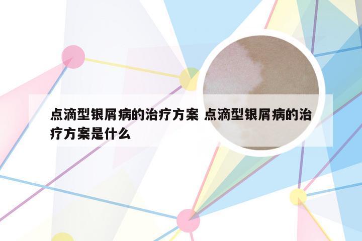 点滴型银屑病的治疗方案 点滴型银屑病的治疗方案是什么