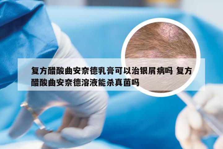 复方醋酸曲安奈德乳膏可以治银屑病吗 复方醋酸曲安奈德溶液能杀真菌吗