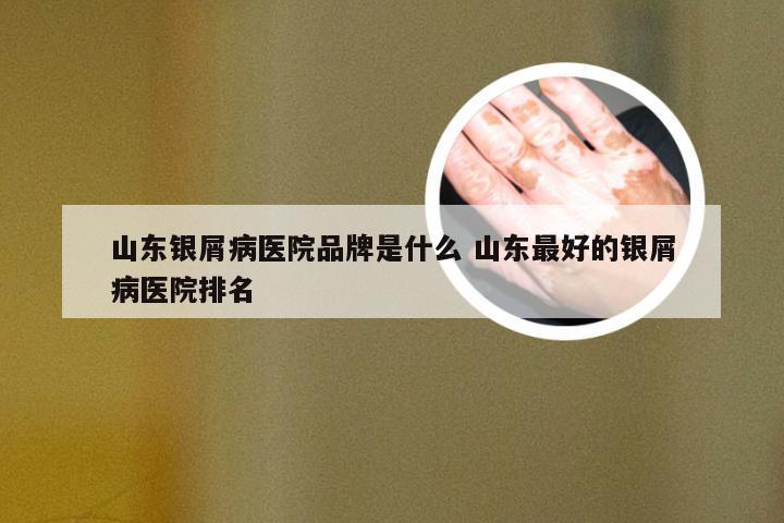 山东银屑病医院品牌是什么 山东最好的银屑病医院排名