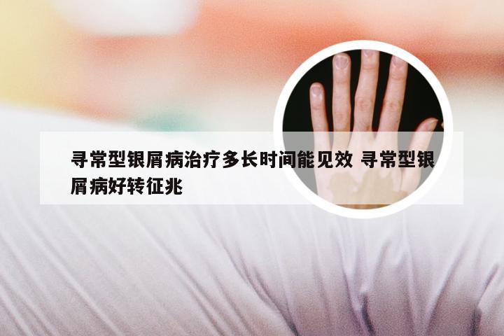 寻常型银屑病治疗多长时间能见效 寻常型银屑病好转征兆