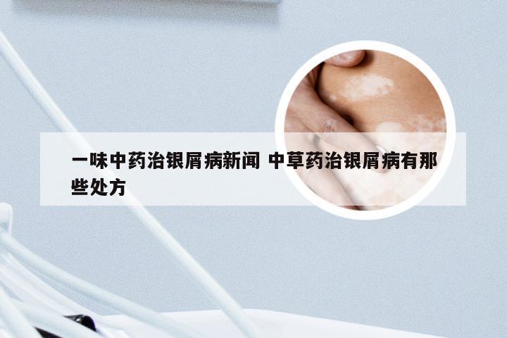 一味中药治银屑病新闻 中草药治银屑病有那些处方