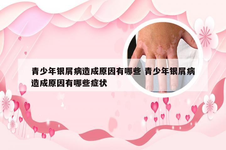 青少年银屑病造成原因有哪些 青少年银屑病造成原因有哪些症状