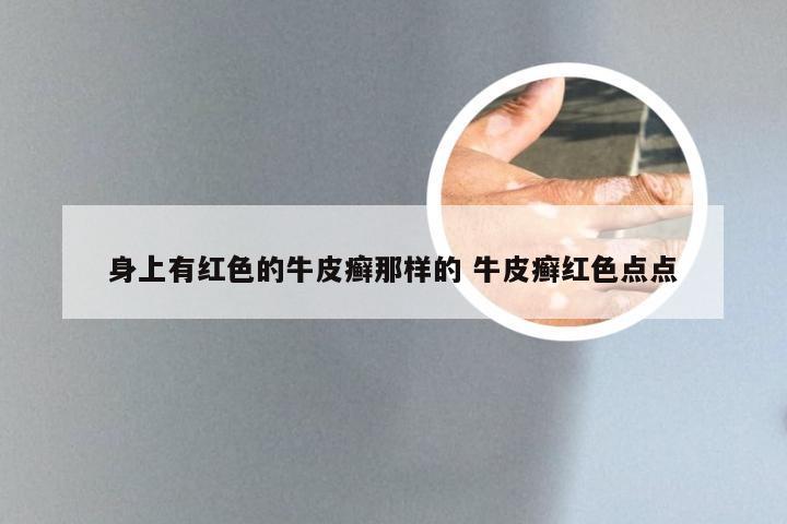 身上有红色的牛皮癣那样的 牛皮癣红色点点