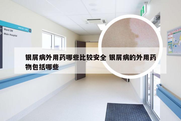 银屑病外用药哪些比较安全 银屑病的外用药物包括哪些