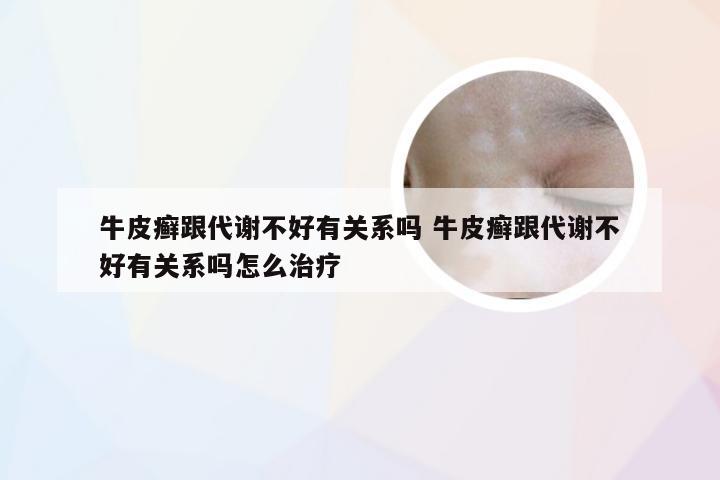 牛皮癣跟代谢不好有关系吗 牛皮癣跟代谢不好有关系吗怎么治疗
