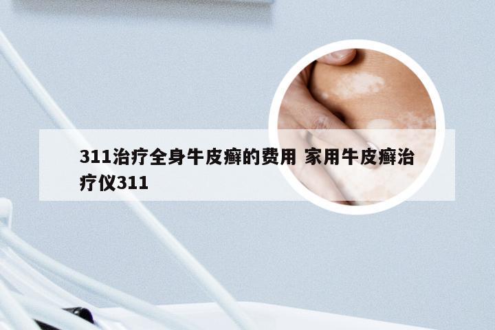 311治疗全身牛皮癣的费用 家用牛皮癣治疗仪311