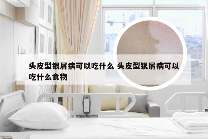 头皮型银屑病可以吃什么 头皮型银屑病可以吃什么食物