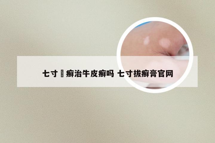 七寸抜癣治牛皮癣吗 七寸拔癣膏官网
