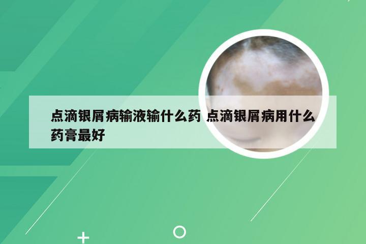 点滴银屑病输液输什么药 点滴银屑病用什么药膏最好