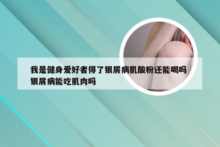 我是健身爱好者得了银屑病肌酸粉还能喝吗 银屑病能吃肌肉吗
