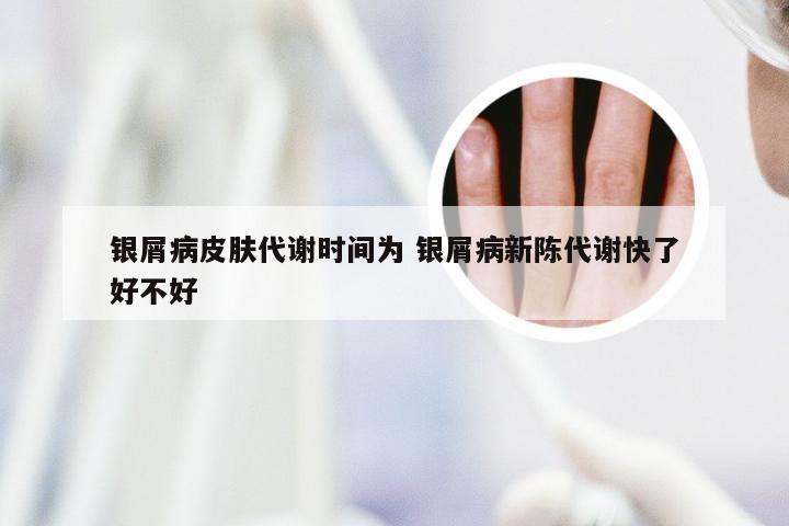 银屑病皮肤代谢时间为 银屑病新陈代谢快了好不好