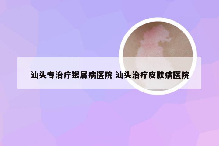 汕头专治疗银屑病医院 汕头治疗皮肤病医院