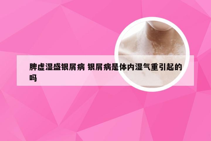 脾虚湿盛银屑病 银屑病是体内湿气重引起的吗