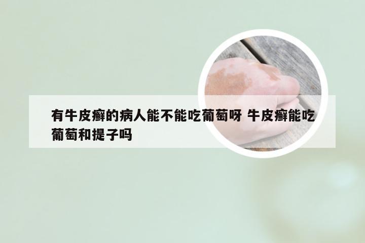 有牛皮癣的病人能不能吃葡萄呀 牛皮癣能吃葡萄和提子吗