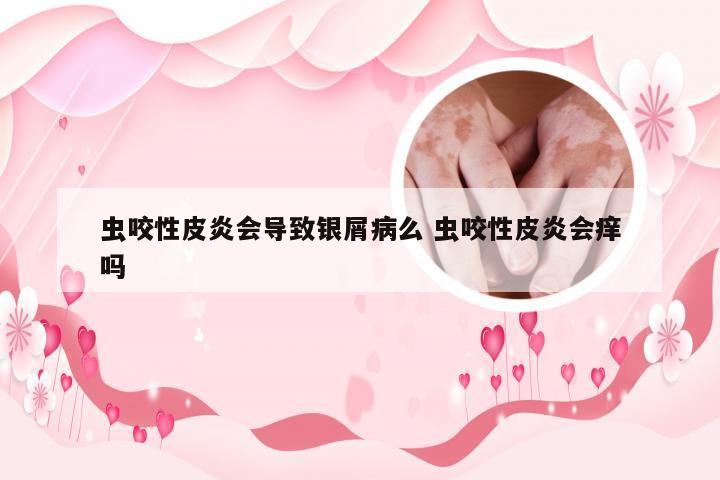 虫咬性皮炎会导致银屑病么 虫咬性皮炎会痒吗