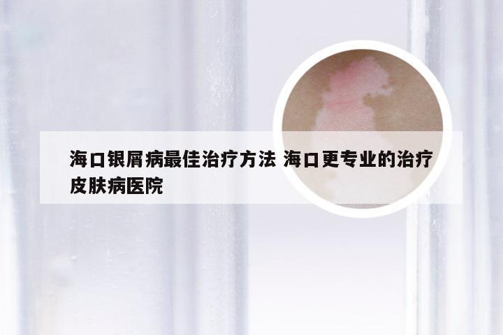 海口银屑病最佳治疗方法 海口更专业的治疗皮肤病医院