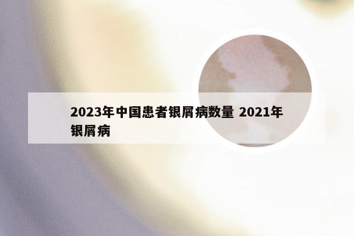 2023年中国患者银屑病数量 2021年银屑病