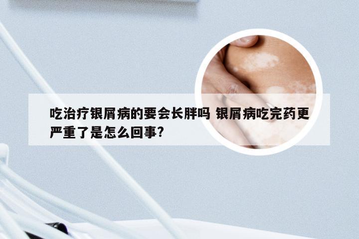 吃治疗银屑病的要会长胖吗 银屑病吃完药更严重了是怎么回事?