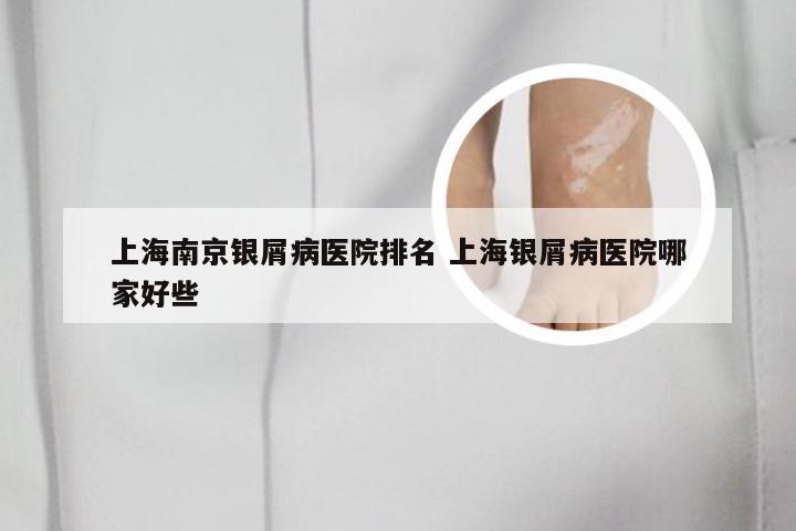 上海南京银屑病医院排名 上海银屑病医院哪家好些
