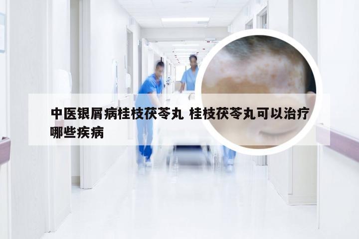 中医银屑病桂枝茯苓丸 桂枝茯苓丸可以治疗哪些疾病