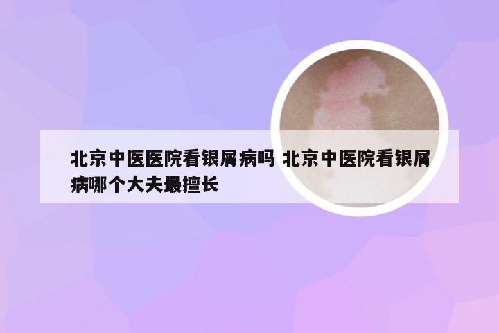 北京中医医院看银屑病吗 北京中医院看银屑病哪个大夫最擅长