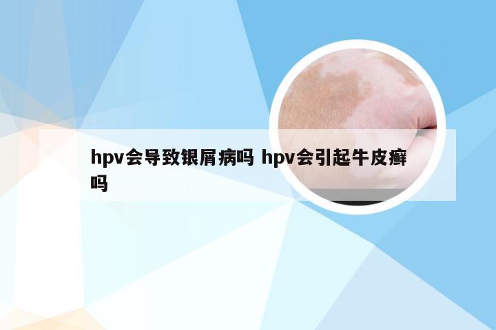 hpv会导致银屑病吗 hpv会引起牛皮癣吗